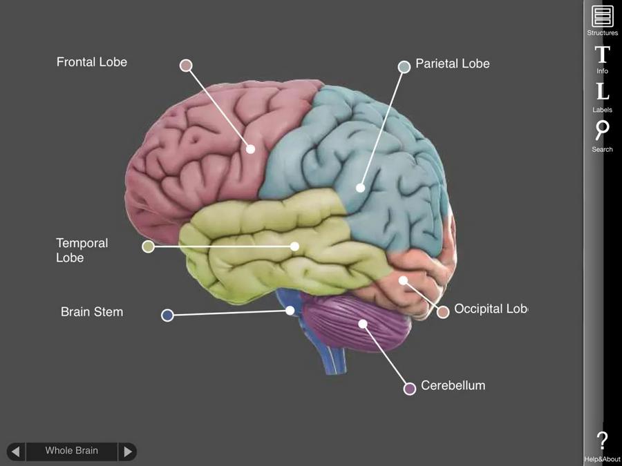 3D Brain